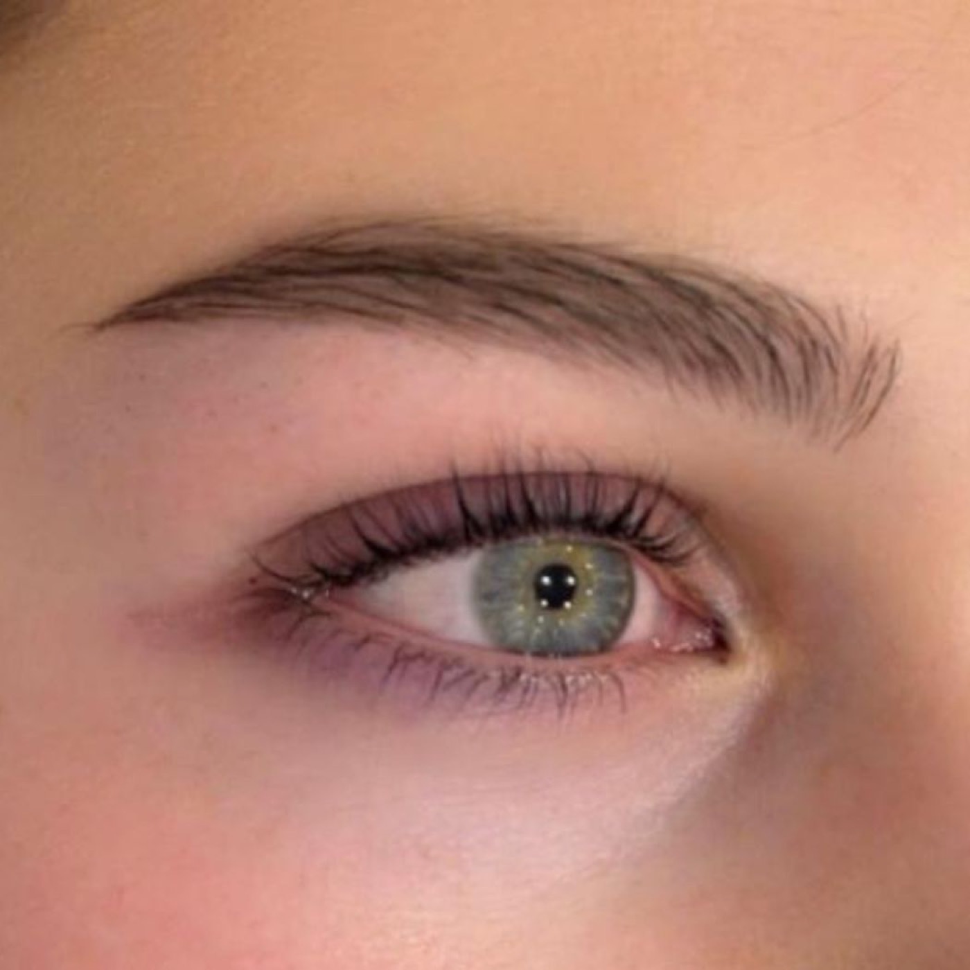 Behandlungsergebnis bei MB Beauty Treatments