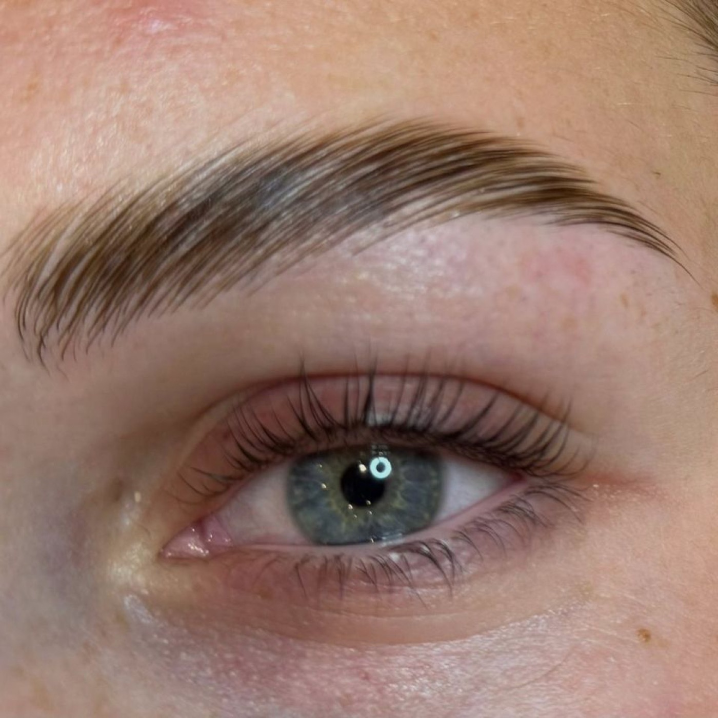 Hautpflege-Ergebnis MB Beauty Treatments
